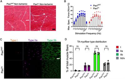 Muscle progenitor cells are required for skeletal muscle regeneration and prevention of adipogenesis after limb ischemia